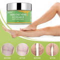 Varicose Vein Cream – Redness, Leg Fatigue & Pain Relief with Natural Herbal Ingredients | Phonax Services
