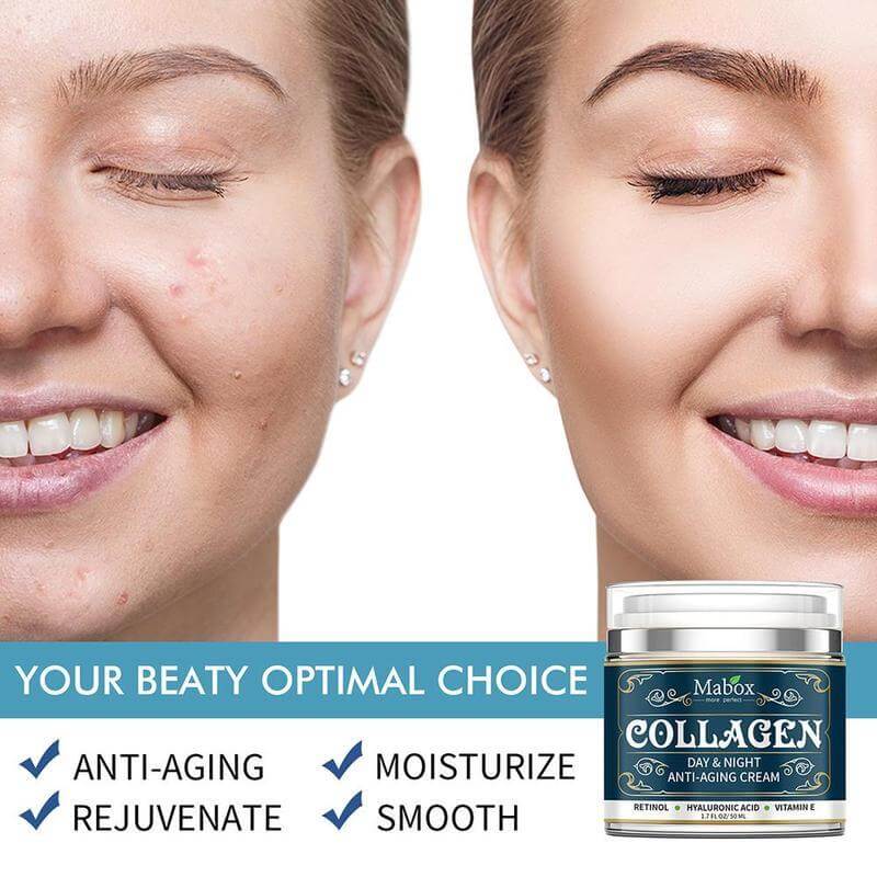Collagen Face Cream – Anti-Aging Day & Night Moisturizer for Neck & Face with Retinol Hydration | Phonax Services