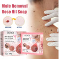 EELHOE Mole Removal Rose Oil Soap – Pain and Scar Free Formula | Phonax Services