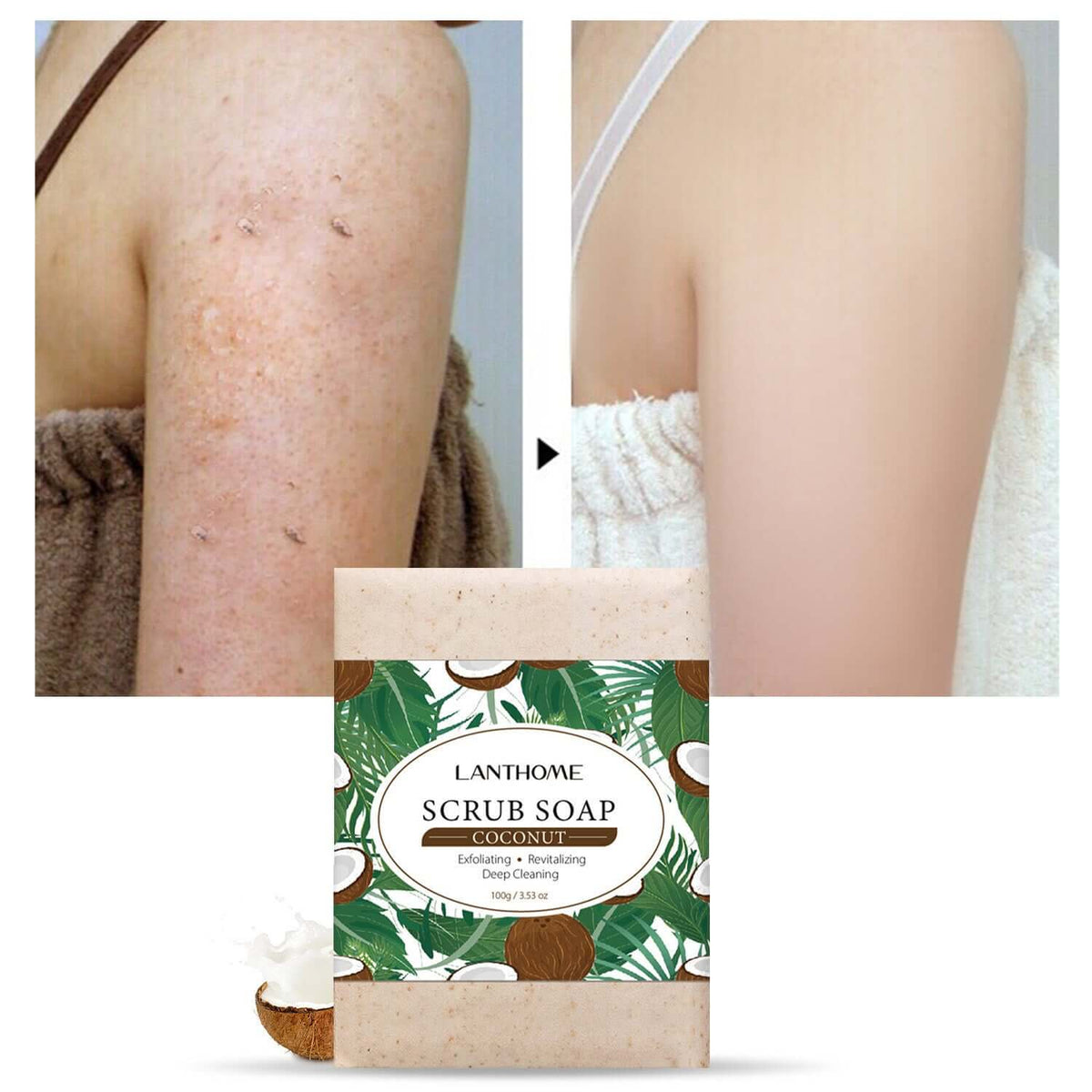 Lanthome Coconut Scrub Soap – Exfoliating and Revitalizing Deep Cleansing | Phonax Services