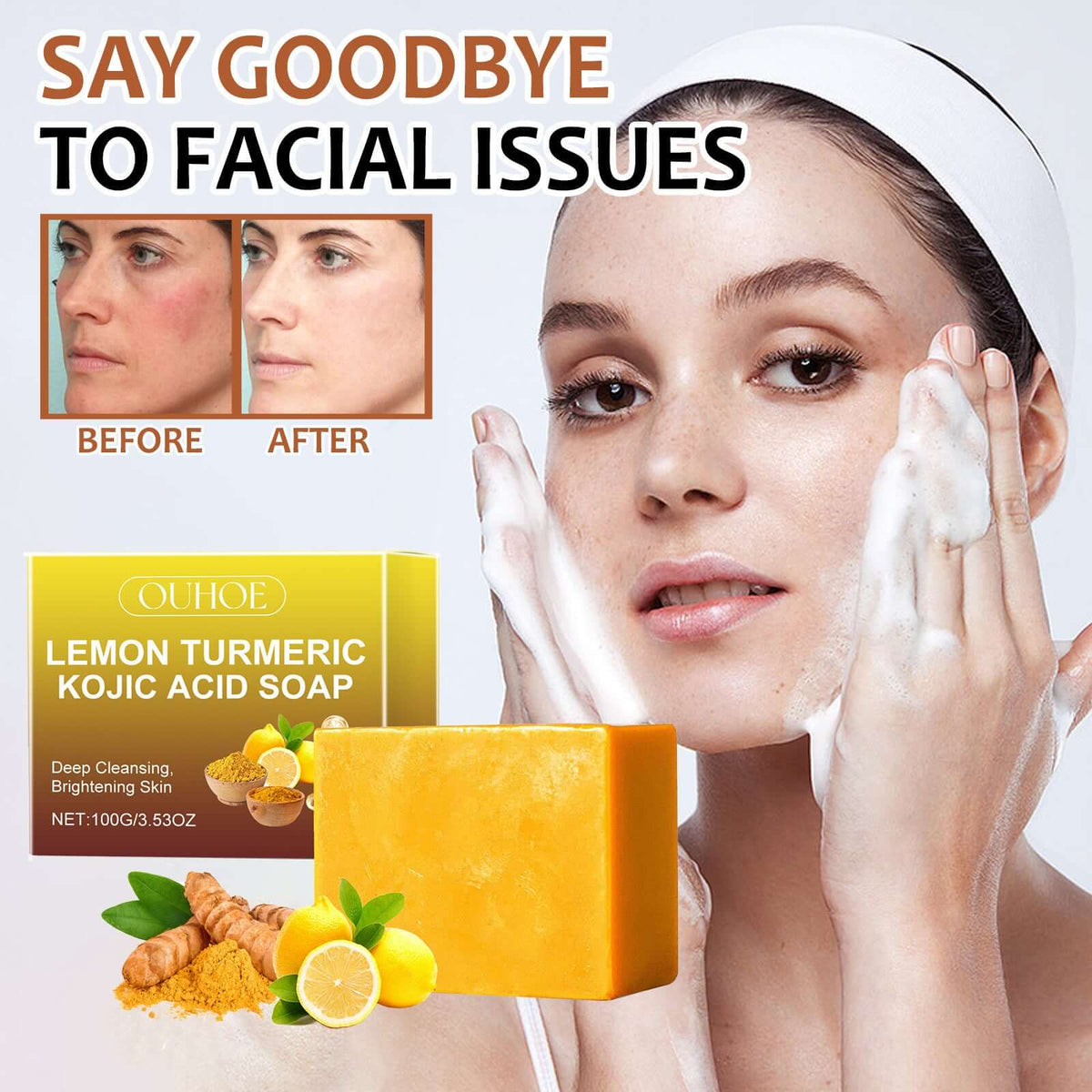 OUHOE Lemon Turmeric Kojic Acid Soap – Deep Cleansing and Brightening Skin | Phonax Services