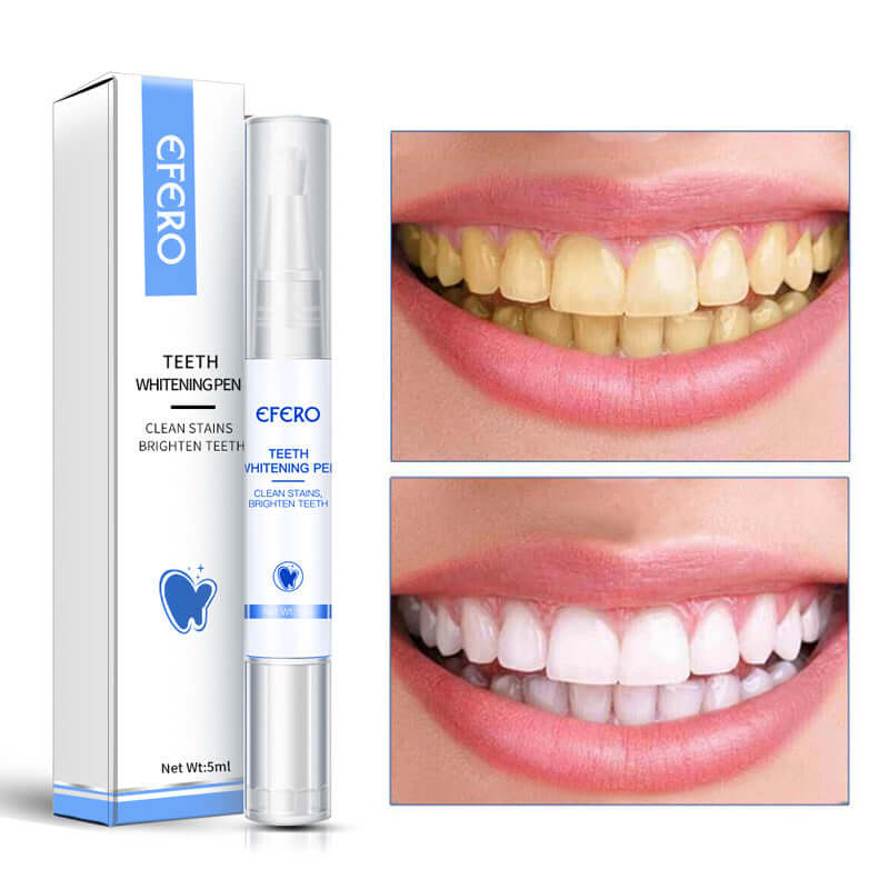 Teeth Whitening Pen Cleaning Serum Remove Plaque Stains Dental | Phonax Services
