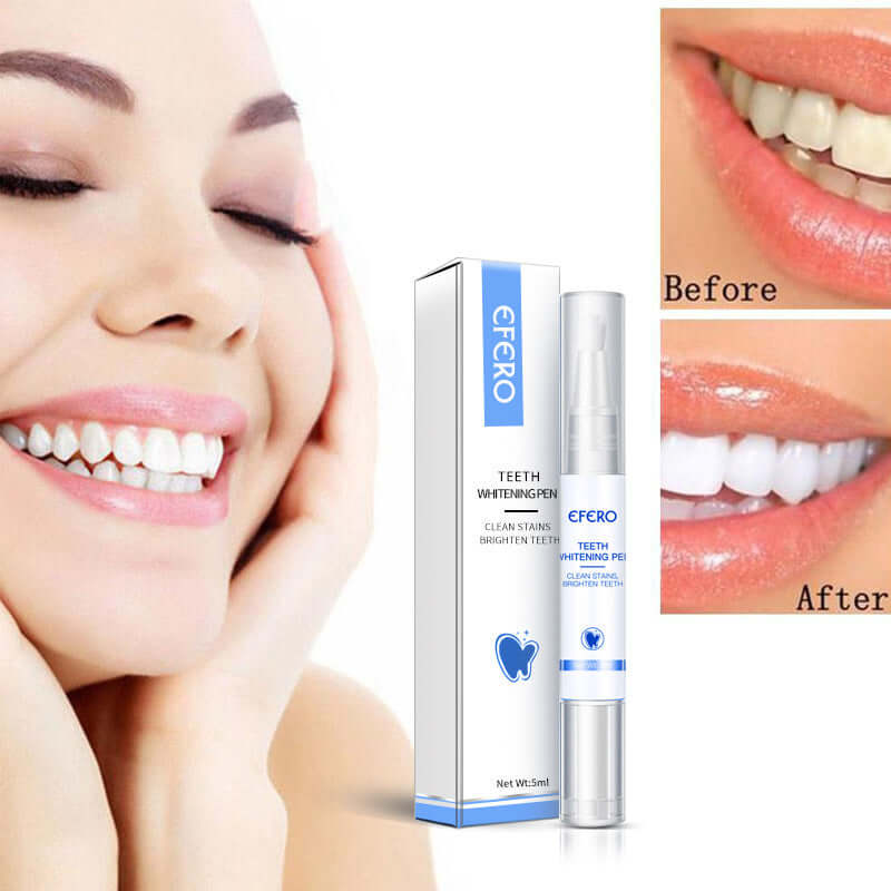 Teeth Whitening Pen Cleaning Serum Remove Plaque Stains Dental | Phonax Services