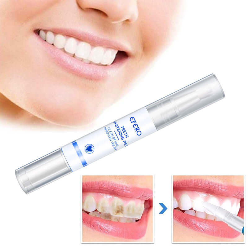 Teeth Whitening Pen Cleaning Serum Remove Plaque Stains Dental | Phonax Services